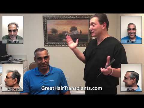 Dr. Bret Bolton patient Rolando Maxharvest plus procedure