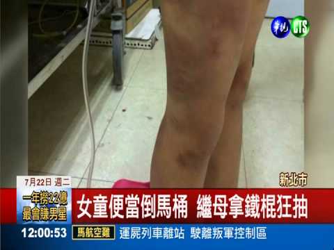 管教孩子? 父女友重打女童遍體鱗傷