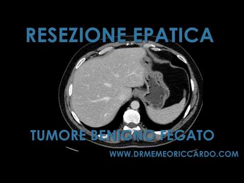 Carpale trattamento di artrite congiunta puledro Raggi X polso