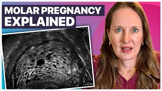 Molar Pregnancy: The Rare Pregnancy Complication Explained