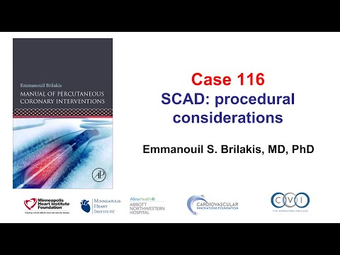 Case 116: PCI Manual - SCAD PCI troubleshooting