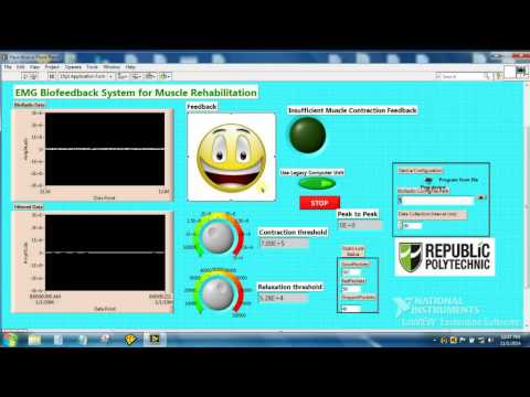 EMG Biofeedback System for Muscle Rehabilitation
