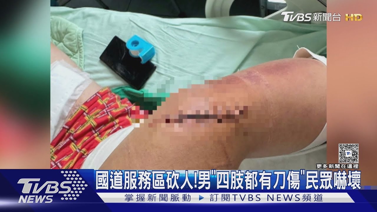 國道一號仁德服務區砍人!男「四肢」都有刀傷 民眾人心惶惶