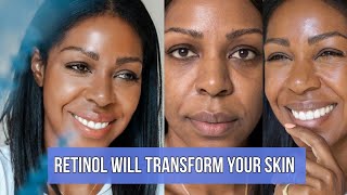 Download lagu You Need To Try Olay Retinol24 Night Moisturizer Now (Before & After Shots) - SKIN TRANSFORMATION mp3