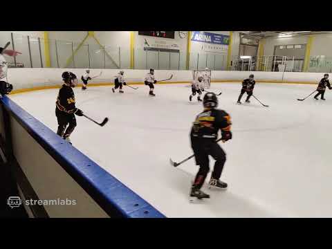 KalPa K vs K Laser V