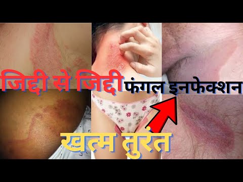 Rosden Ayurvedic malam,forFemale pecific Cream Lotion,Ointment,Cream,Liniment, Lotion,Gel ,Paste