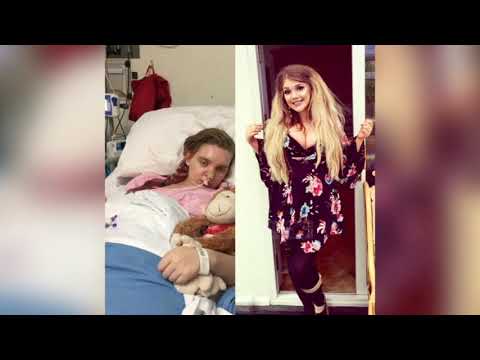 Top News - Gabimisht në psikiatri/ Sot, një modele e suksesshme