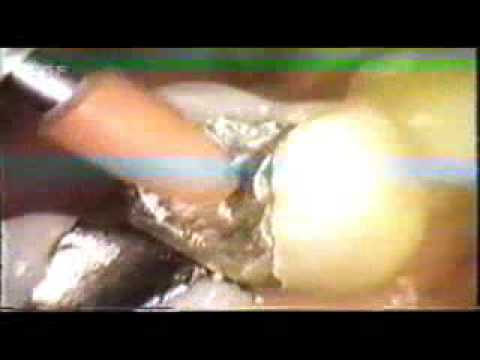 Kennzeichen D - Schädlichkeit von Amalgam