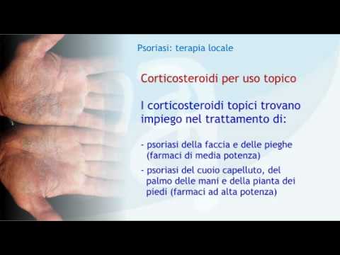 Cura di psoriasi sulle medicine principali Psoriasi di prevenzione di una parte pelosa della testa
