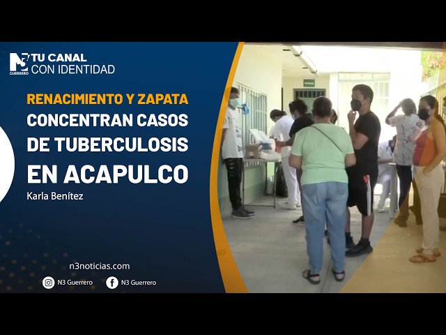 Renacimiento y Zapata concentran casos de tuberculosis en Acapulco