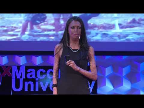 Turia Pitt - TEDxMacquarieUniversity