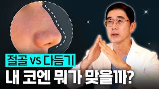 매부리코 절골 vs 다듬기, 내 코엔 뭐가 맞을까? 기준은 이것!✨ | BE THE NEW
