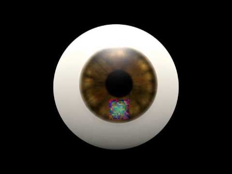 Patterned Contact Lens for Eye Tracking