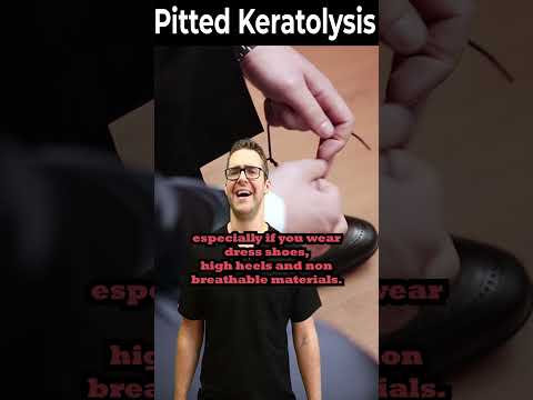 Skin Tag Removal Wart Removal How To Get Rid Of Skin Tags Warts