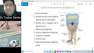 Download Lagu Orthopaedics Practical Video Series (OPVS) : Why Metaphysis is most common site of Osteomyelitis Thumbnail