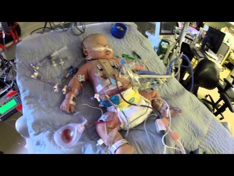 Open Heart Surgery - AVSD repair in baby with Down syndrome
