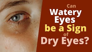 Can Tears  be Sign of Dry Eyes - Your Watery Eyes may be Dry.