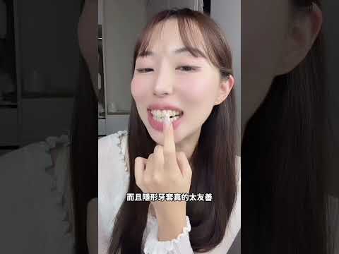 【SOV舒服美】倫倫-戴牙套快一年啦！當初選SOV隱形牙套是明智的選擇～｜SOV數位隱形矯正