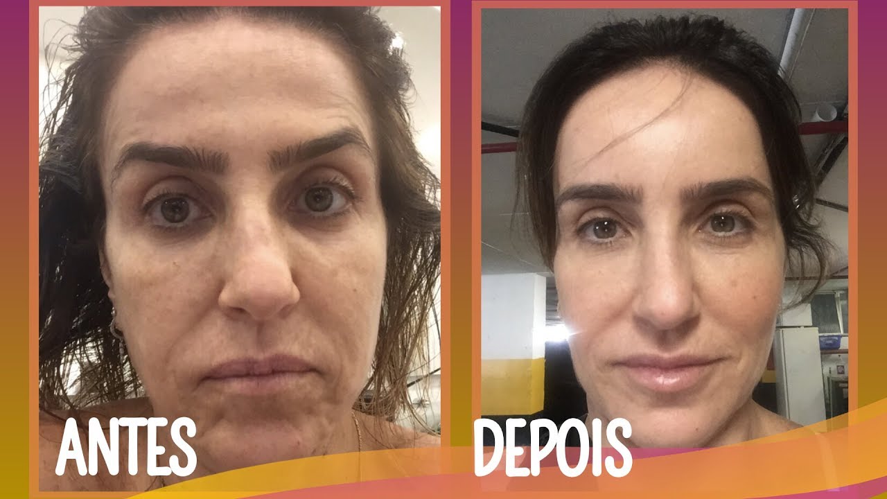 ROSTO JOVEM SEM PLÁSTICA