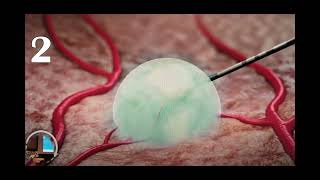 2025 APPLE Final Live