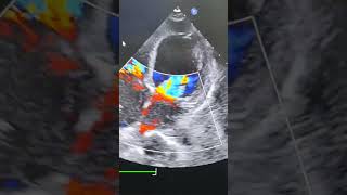 Download lagu #Severe TR #severe MR #2Decho #Echo mp3 Download lagu #Severe TR #severe MR #2Decho #Echo mp3