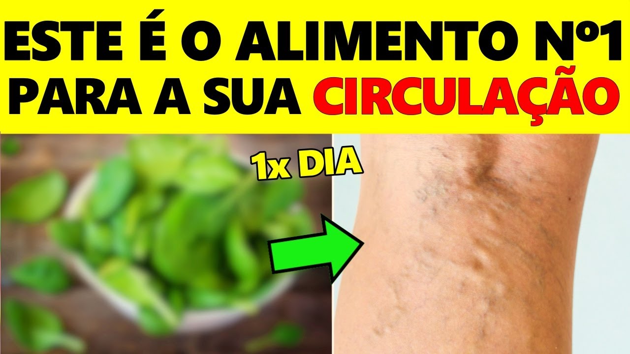 REVELADO! O ALIMENTO Nº1 Que Combate Varizes e Melhora a Circulação
