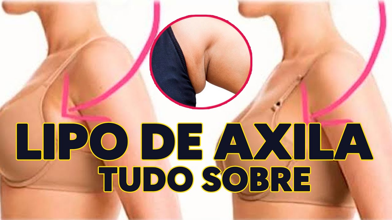 LIPO DE AXILA - VEJA TUDO
