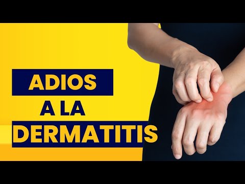 Las eccemas al adolescente El ungüento gioksizon a la eccema las revocaciones