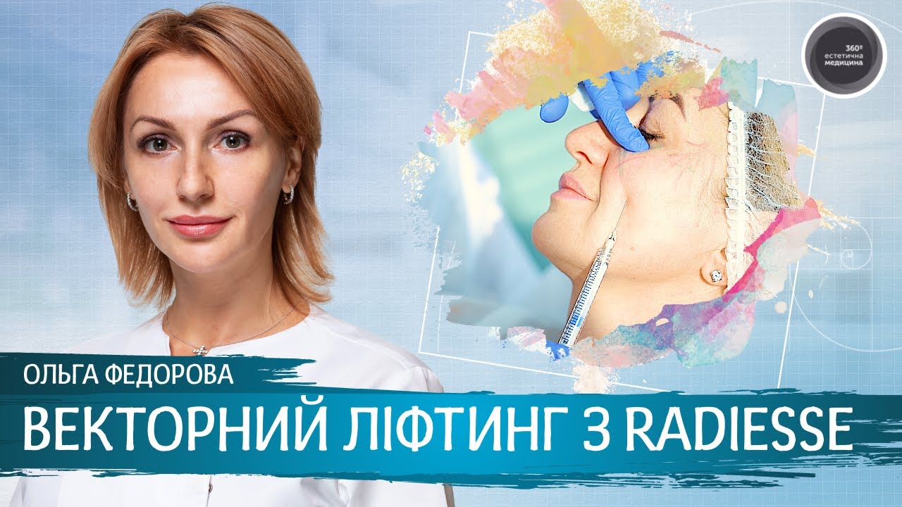 Векторный лифтинг с Radiesse