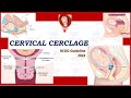 Cervical Cerclage , RCOG Guideline (2022)