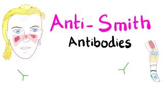 Anti-Smith (anti-Sm) Antibodies; Systemic Lupus Erythematosus