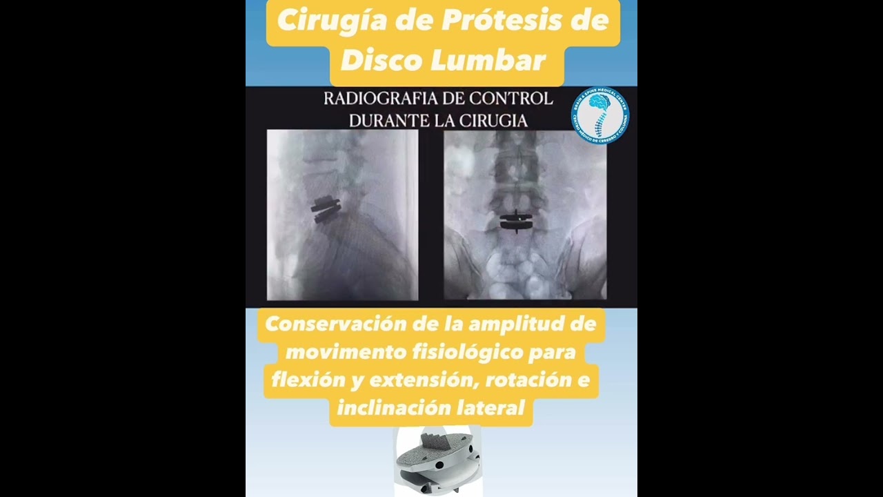 Alan Ferrufino Mejia-41