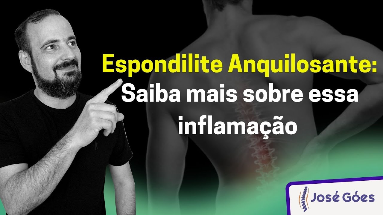 Espondilite Anquilosante: saiba mais sobre essa inflamação | José Góes