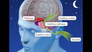 Auditory perception asleep (S. Blatrix, R. Pujol)