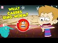 What Causes Ringworms Skin Infection The Dr Binocs Show Peekaboo Kidz