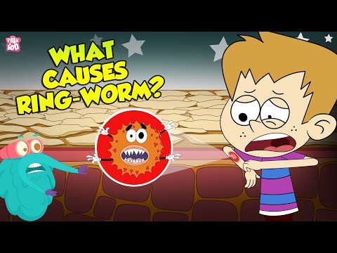 What Causes Ringworms? | Skin Infection | The Dr Binocs Show | Peekaboo Kidz