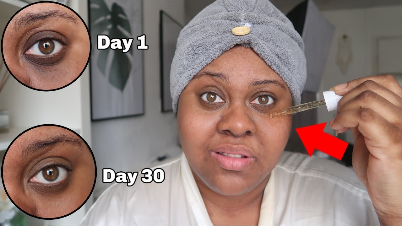 THE ORDINARY CAFFEINE SOLUTION 5% FOR 30 DAYS (Results)