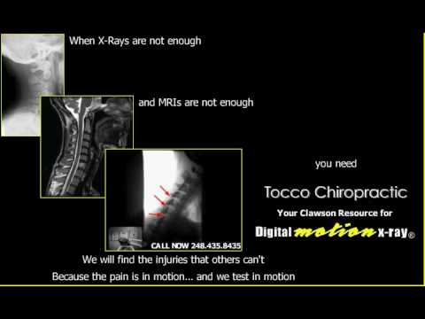When X-Rays Aren't Enough - Digital Motion X-Ray - DMX of Michigan