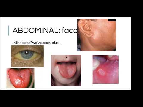 OSCE Masterclass 3: Approach to the abdominal examination