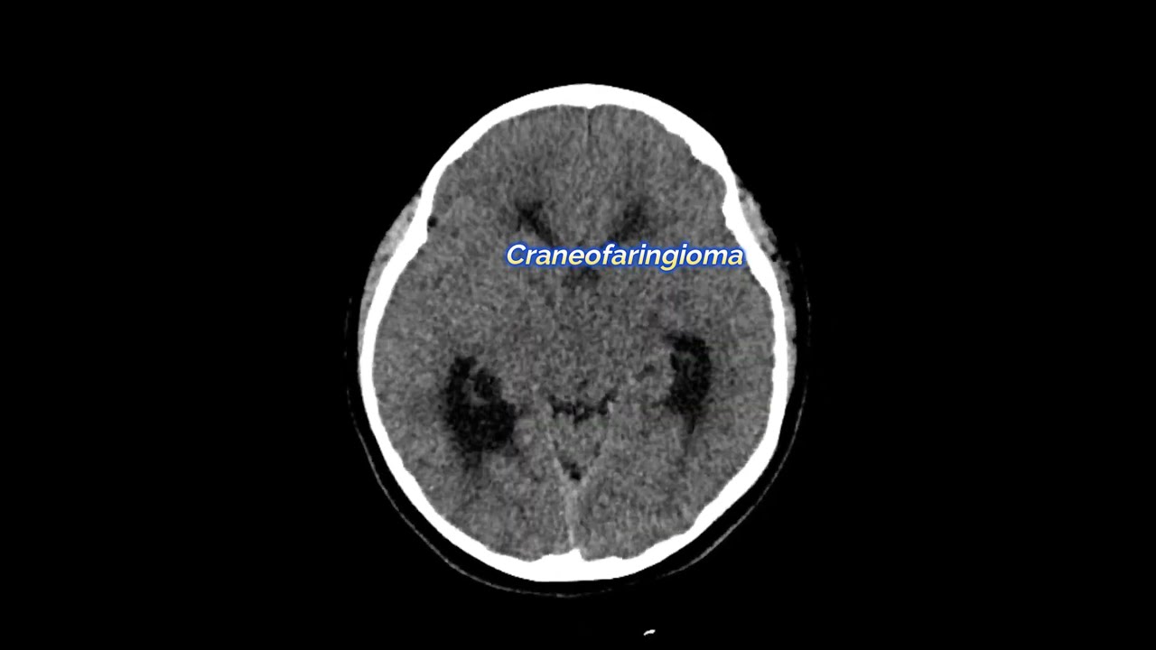 David Tafur Muñoz-2505