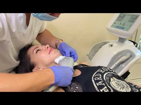 HIFU Ultraformer 3 Lifting sin Cirugía