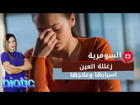 شاهد بالفيديو.. زغللة العين اسبابها وعلاجها