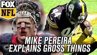 Mike Pereira explains what gross things won't force you to leave a game by FOX Sports