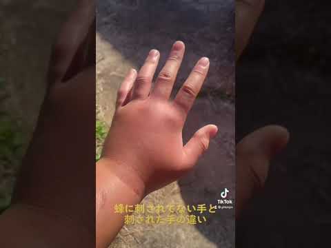 園芸 蜜の木、蜂の木、十万の花の木