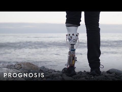 這位麻省理工學院的工程師打造了自己的仿生腿。 (This MIT Engineer Built His Own Bionic Leg)