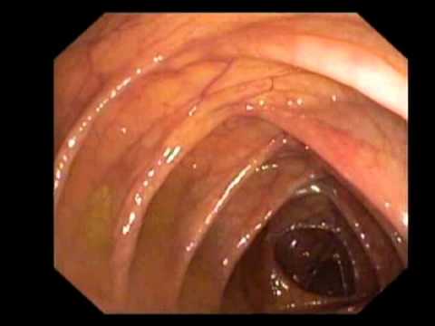 download lagu mp3 mp4 Ashutosh Mohapatra, download lagu Ashutosh Mohapatra gratis, unduh video klip Ashutosh Mohapatra