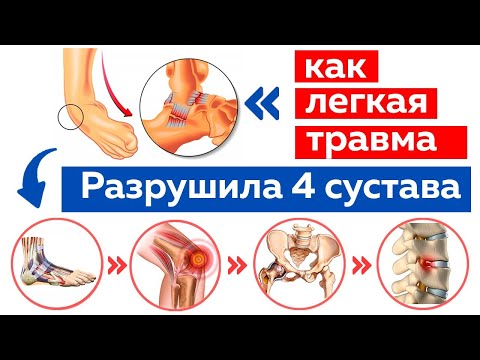 Проверь себя! Опасная травма, которую получали все! Чего стоит бояться?