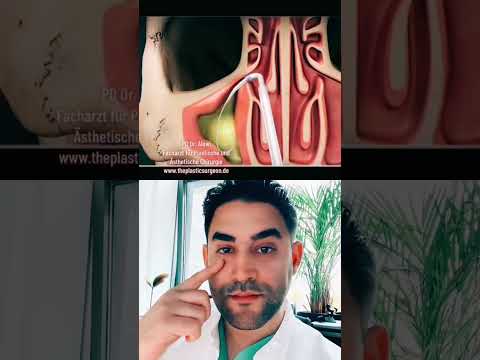 Constant sinusitis? This is the reason...