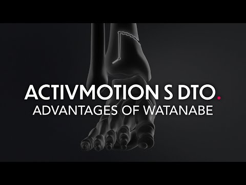 Activmotion S DTO - Advantages of the Watanabe / Brilhault osteotomy