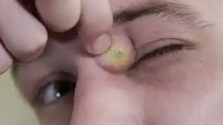 That is not a good spot